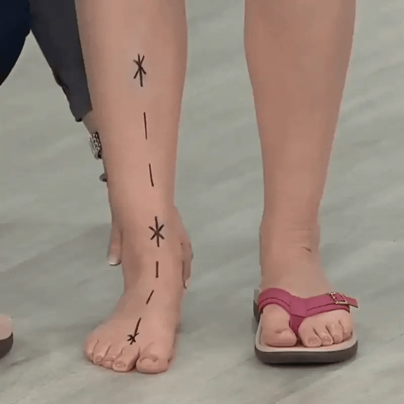 Sandales Orthopédiques Miami